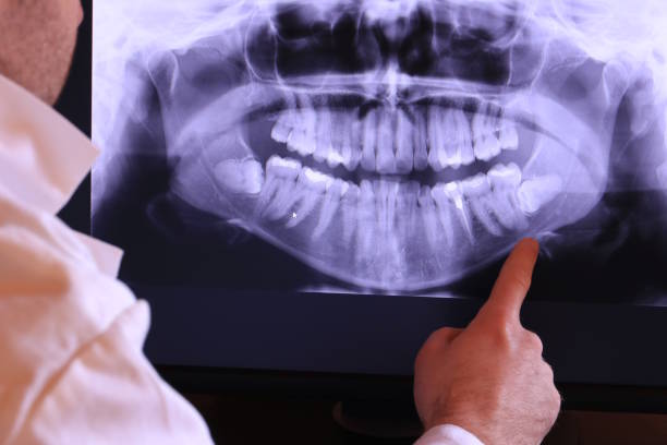 Best Emergency TMJ Treatment in Caon City, CO