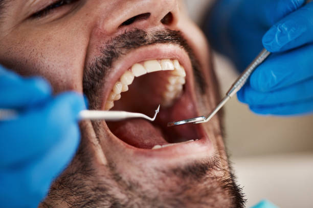 Best Emergency Dental Care for Broken or Chipped Teeth in Caon City, CO